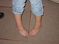 DSC01419 swollen ankels